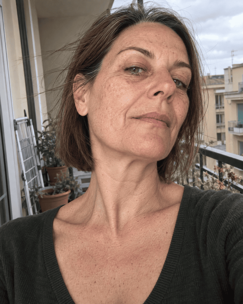 Dopo · 5 mesi