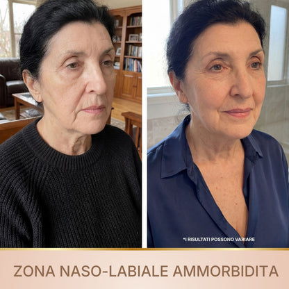 BioChroma - Siero con Peptidi di Seta e Collagene