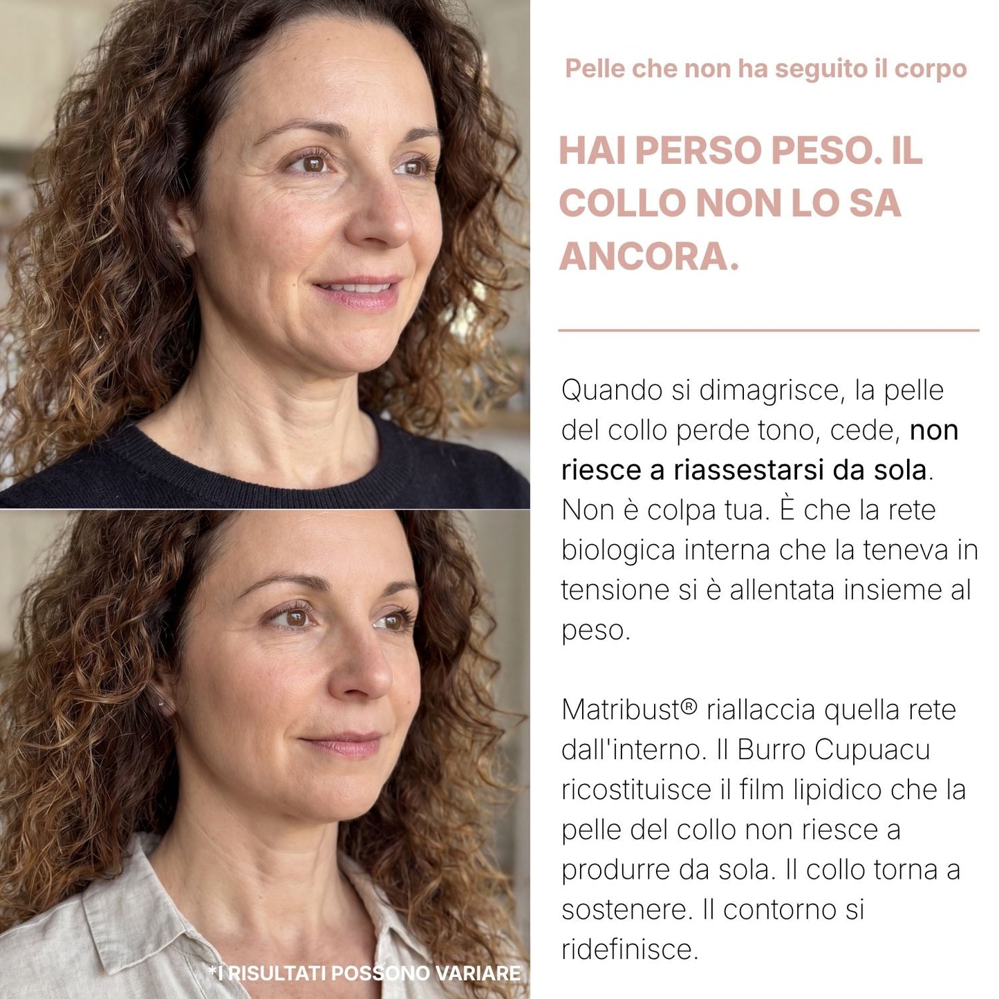 Biochroma - Crema Collo Liftante & Rassodante