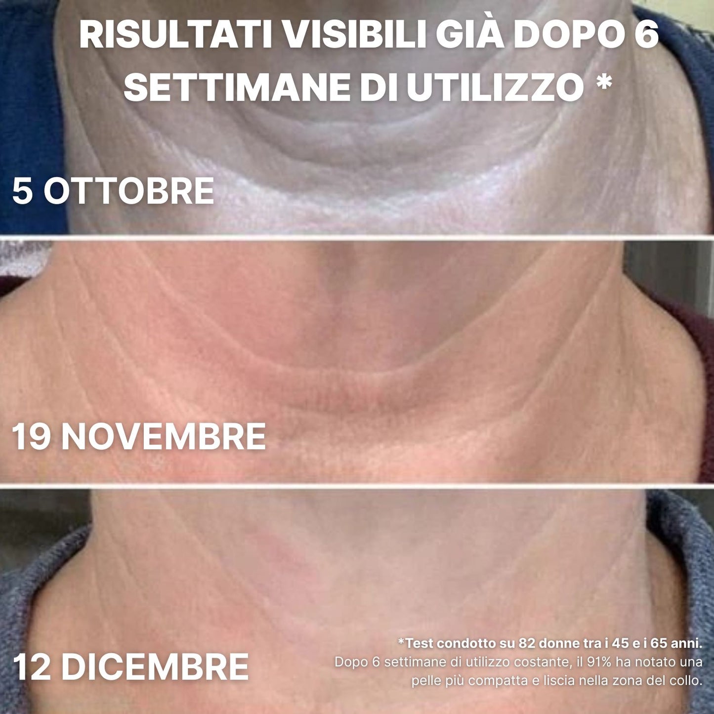 Crema Collo BioChroma™ – Effetto Lifting in 28 Giorni