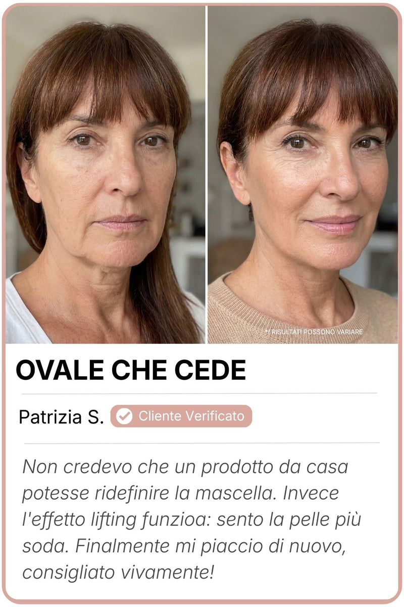 Efekty przed i po – klientka 3