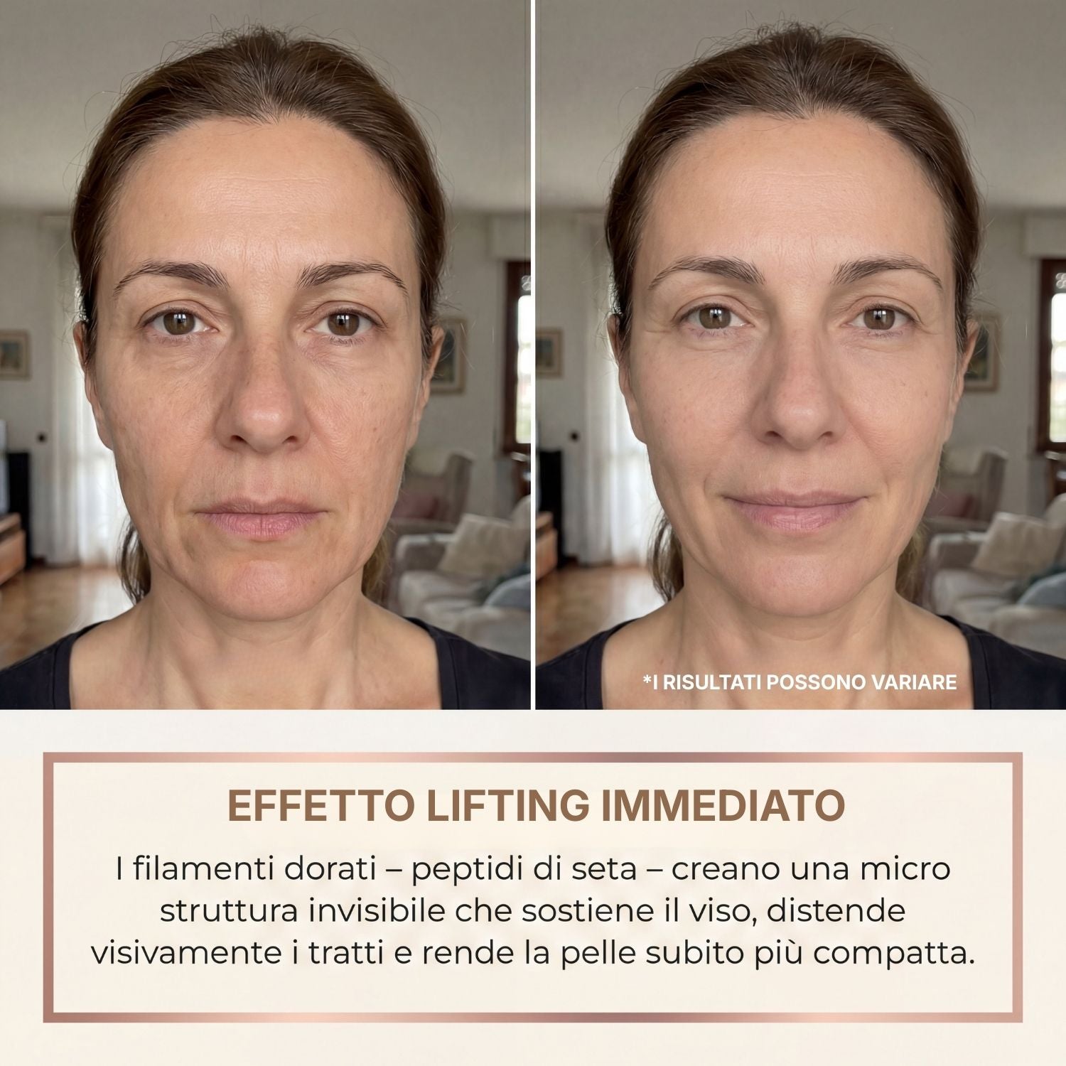 Siero antirughe BioChroma ai peptidi di seta con filamenti dorati e siringa cosmetica