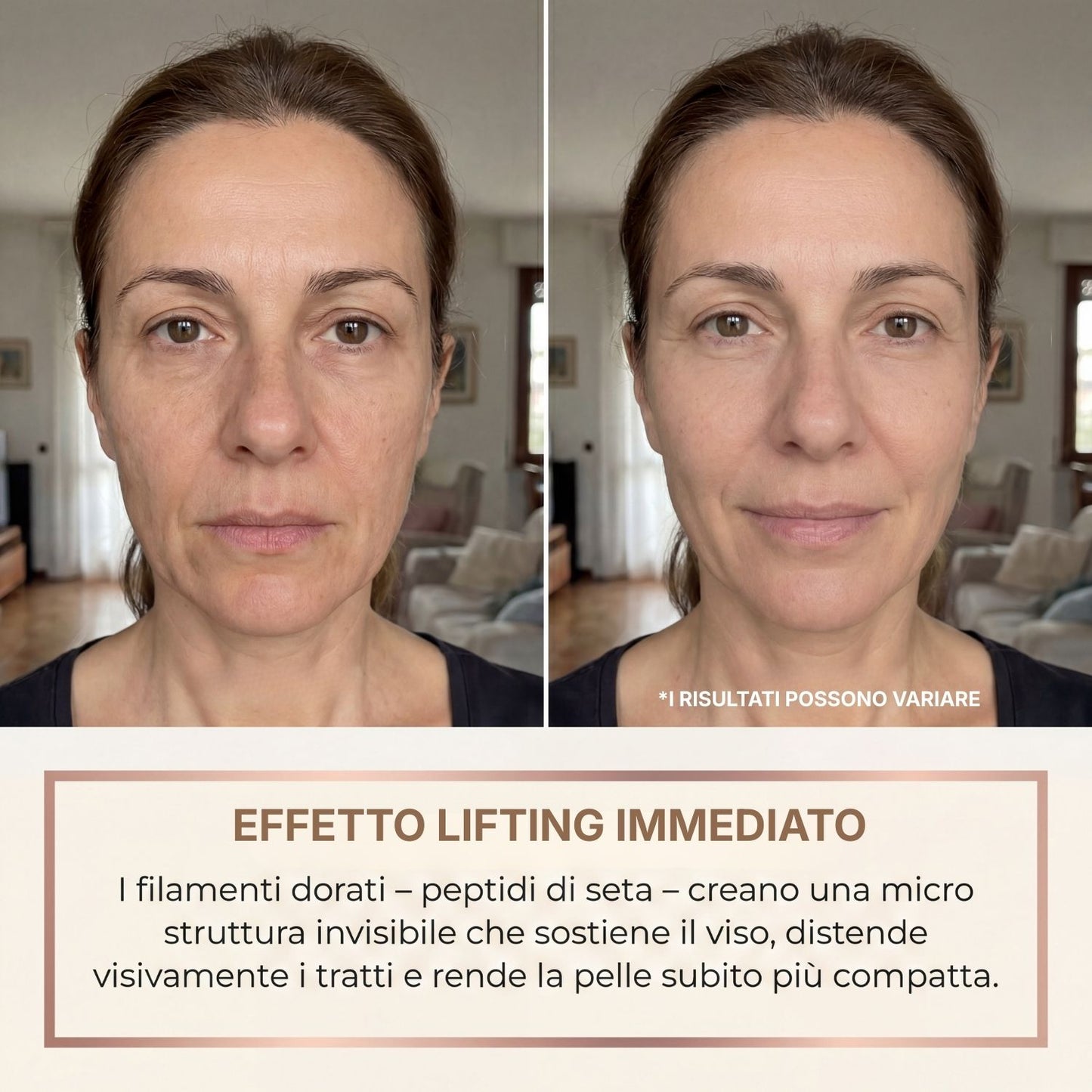 BioChroma - Siero con Peptidi di Seta e Collagene