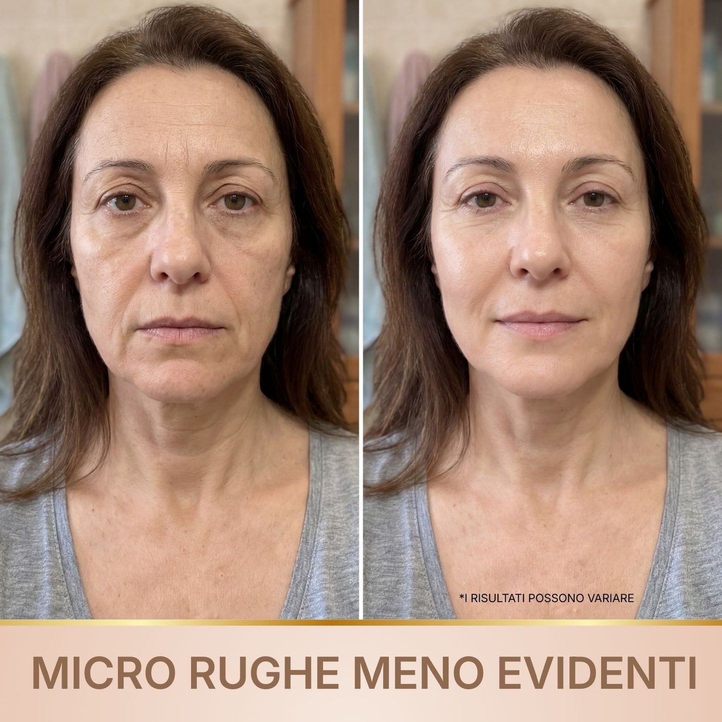 BioChroma - Siero con Peptidi di Seta e Collagene