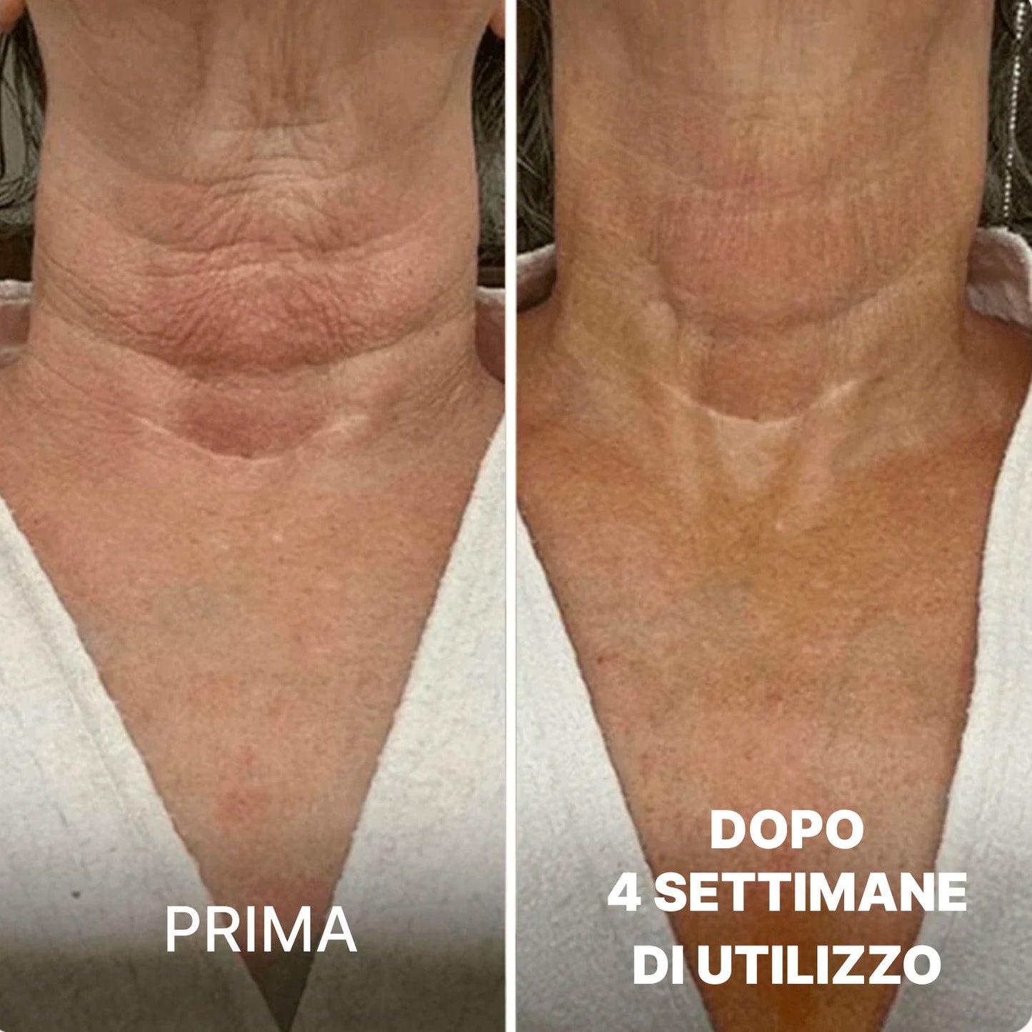Crema Collo BioChroma™ – Effetto Lifting in 28 Giorni