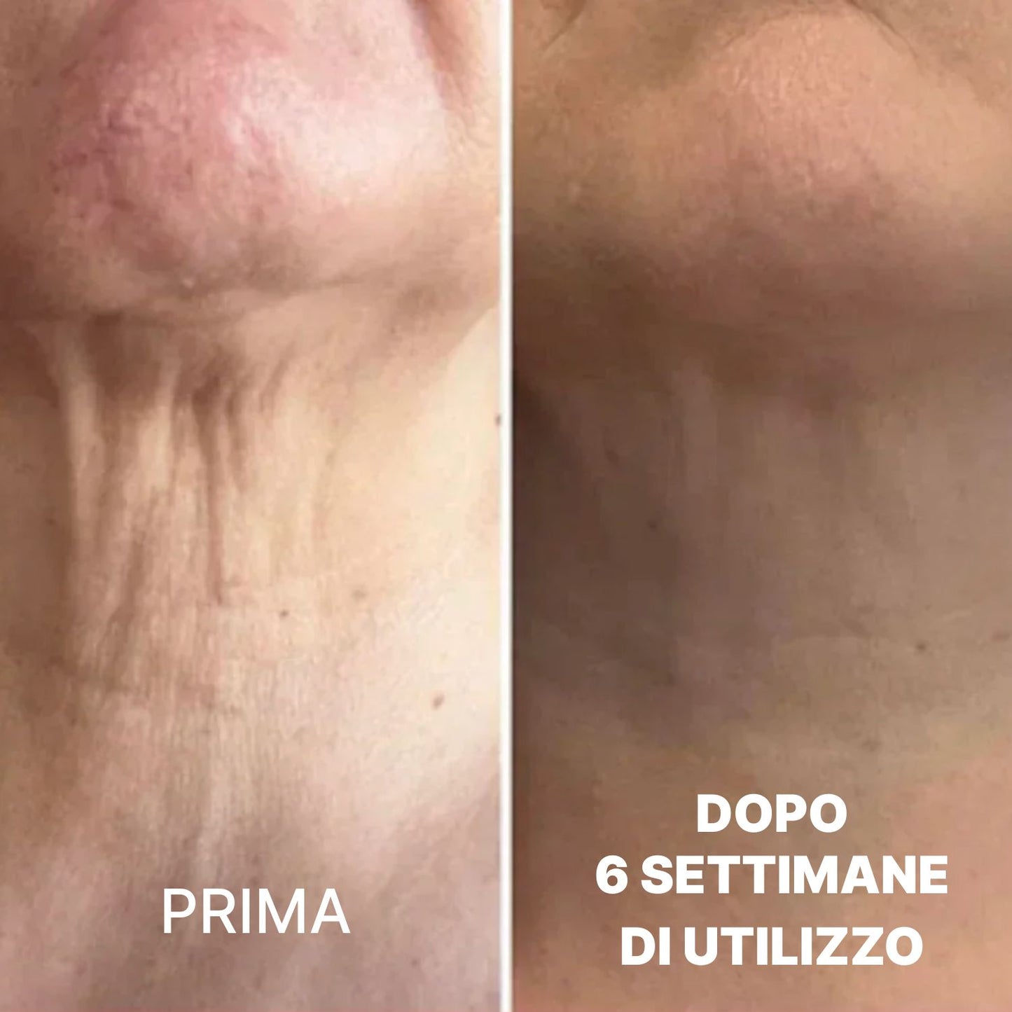 Crema Collo BioChroma™ – Effetto Lifting in 28 Giorni