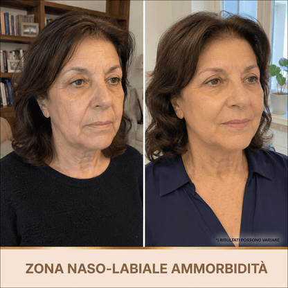 Siero Luminosità Immediata PDRN - Skin Care Coreana Biochroma