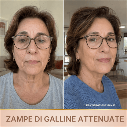 Siero Luminosità Immediata PDRN - Skin Care Coreana Biochroma