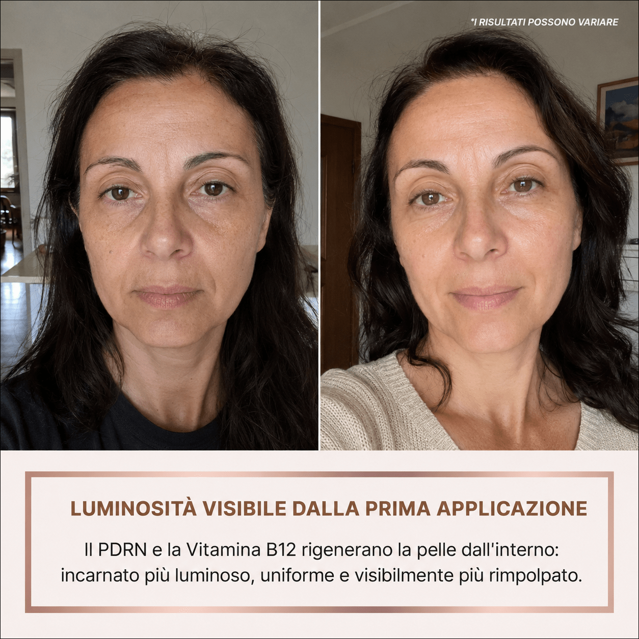 Siero Luminosità Immediata PDRN - Skin Care Coreana Biochroma