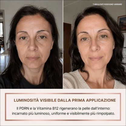 Siero Luminosità Immediata PDRN - Skin Care Coreana Biochroma