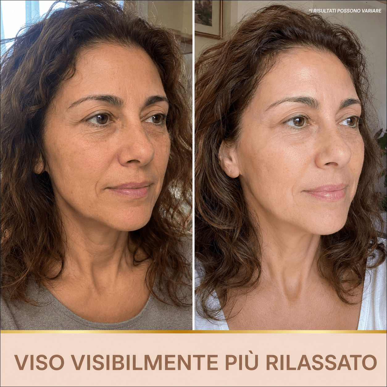 Siero Luminosità Immediata PDRN - Skin Care Coreana Biochroma