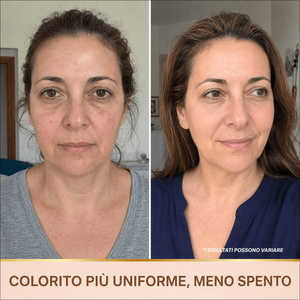 Siero Luminosità Immediata PDRN - Skin Care Coreana Biochroma
