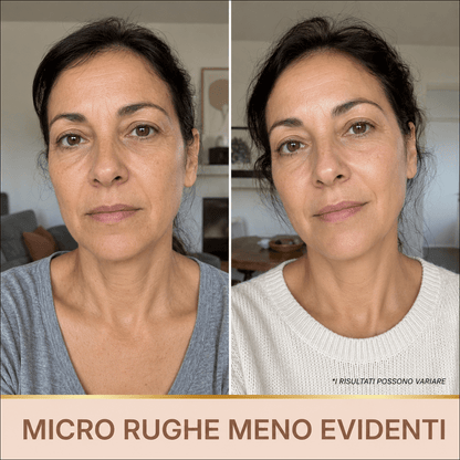 Siero Luminosità Immediata PDRN - Skin Care Coreana Biochroma