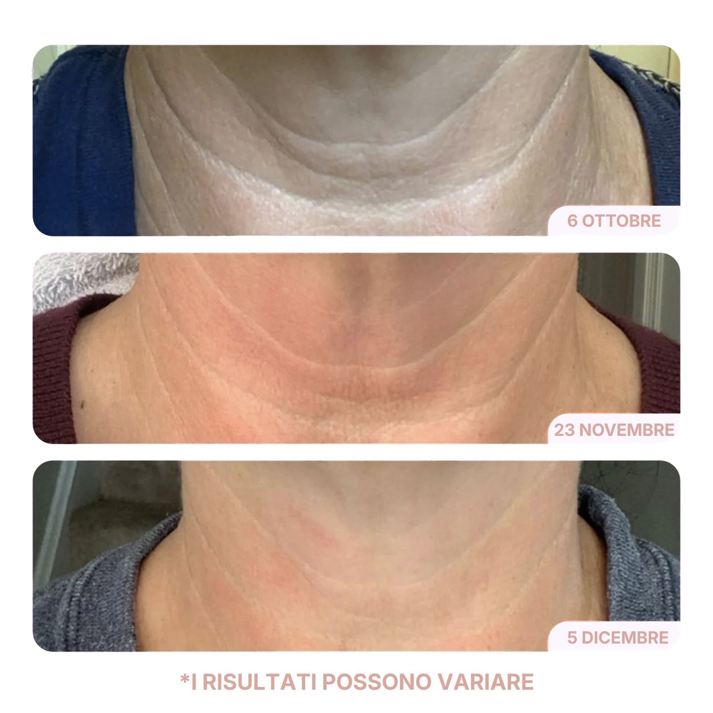 Crema Collo Liftante & Rassodante