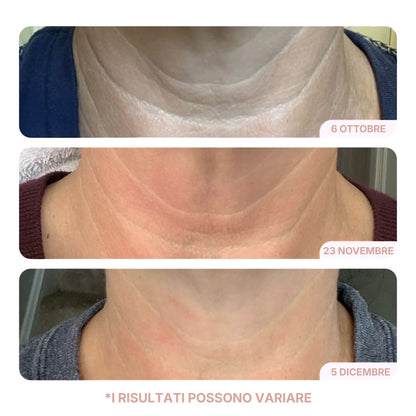 Crema Collo Liftante & Rassodante
