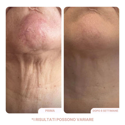 Crema Collo Liftante & Rassodante